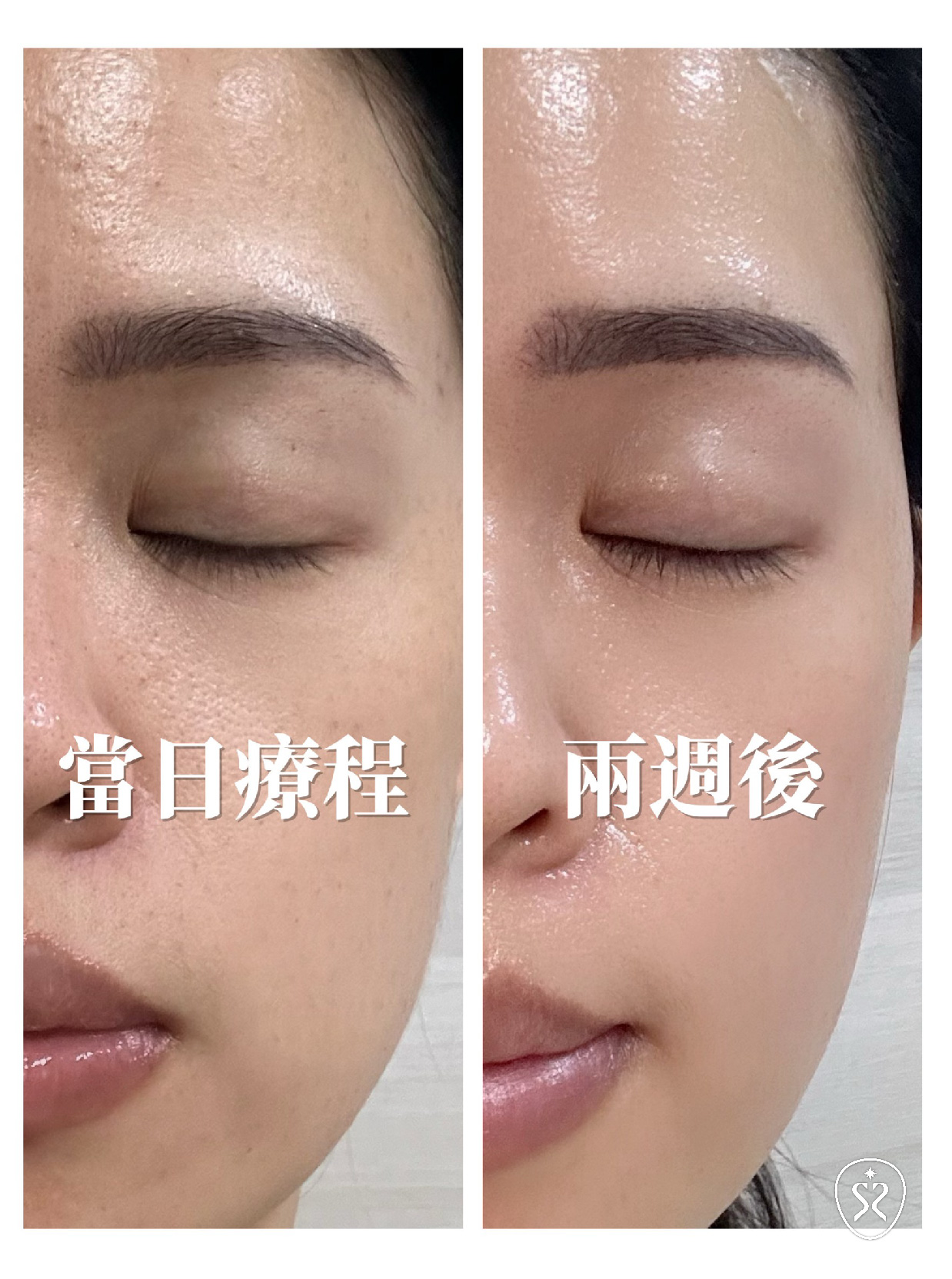 修秘水光改善膨潤飽滿與細緻毛孔